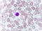 Lymphocyte cell in blood smear