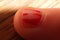 Macro Child finger nail with chipped polish