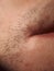 Macro close up blurred yellow skin above mouth corner with short facial hair