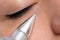 Macro close up detail of laser plasma pen reducing eye wrinkles