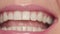 Macro close up woman`s lips laughing