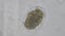 Macro Hookworm eggs parasite in stool examination