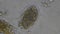 Macro Hookworm eggs parasite in stool examination