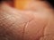 macro skin of human hand.Medicine and dermatology concept. Details of human skin