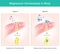 Magnesium homeostasis in body.