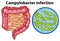 Magnified cells of campylobacteri infection