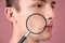 Magnifying young man`s skin with acne problem