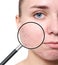 Magnifying young woman`s skin with acne problem