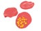 Malaria infected blood cells