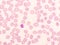 Malaria parasite in red blood cells