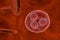 Malaria. Plasmodium vivax in early trophozoite ring stage inside red blood cell