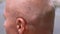 Male Bald Head with Glimpses of Gray Hair in the Rays of Sunlight in Nature