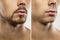 Male face Before and after shaving comparison.