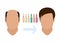 Male hair loss treatment. Before and after stages of hair growth procedure on face silhouette. Alopecia infographic