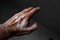 The male hand is affected by vitiligo. Health.