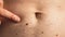 Male hand showing birthmarks on skin body stomach part. Close up detail of the bare skin. Health Effects of UV Radiation