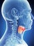Male larynx - cancer