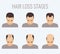 Male pattern baldness stages