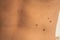 Male showing birthmarks on skin body stomach part. Close up detail of the bare skin. Health Effects of UV Radiation. Man