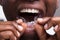 Man Adjusting Transparent Aligners In His Teeth