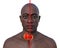 A man with enlarged thyroid gland, 3D illustration