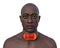 A man with enlarged thyroid gland, 3D illustration