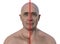 A man with enlarged thyroid gland, 3D illustration