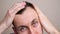 man examines a bald spot on his head in a mirror in slow motion