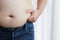 Man with fat belly in dieting concept. Overweight man touching his fat belly and want to lose weight