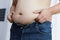 Man with fat belly in dieting concept. Overweight man touching his fat belly and want to lose weight