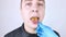 The man has a yellow tongue. Painful yellow coating on the mucous membrane of the tongue. Diseases of the gastrointestinal tract,