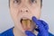 The man has a yellow tongue. Painful yellow coating on the mucous membrane of the tongue. Diseases of the gastrointestinal tract,