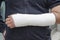 Man with his broken arm. Arm in cast.