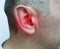 Man hurts his ear a symptom  pressureof the disease sickness