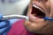 Man keeping mouth open for dental treatment