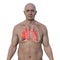 A man with lung mucormycosis lesion, 3D illustration