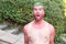 Man with pale complexion getting sunburnt