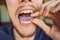 Man placing a bite plate in his mouth to protect his teeth at night from grinding caused by bruxism, close up view of
