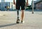 Man with prosthetic leg.