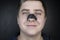 A man puts on and removes a strip for the nose from black dots. Coal cleaning strips from blackheads and comedones. The concept of