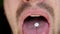 Man puts white pill in mouth. Little white medication piled on the tongue. Close up