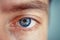 Man\'s eye