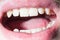 Man`s open mouth close-up teeth. Clean natural teeth