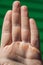 A man`s palm with four fingers, calluses and dry skin . Selective focus