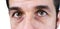 Man\'s vey tired eyes