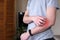 A man scratching an itchy hand. Dermatitis, eczema, allergies, psoriasis. Close-up of a man with an itchy rash on his arm, the