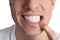 Man showing inflamed gums on white background, closeup