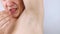 The man shows his sweaty armpits to the camera. Close-up of sweat drops. Gland problems. Hyperhidrosis, increased sweating, anhidr