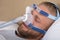 Man With Sleeping Apnea And CPAP Machine