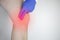 A man suffers from knee pain. Examination by an orthopedist and traumatologist. Redness and swelling of the legs, torn meniscus or